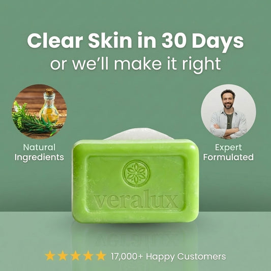 Veralux Antifungical Soap